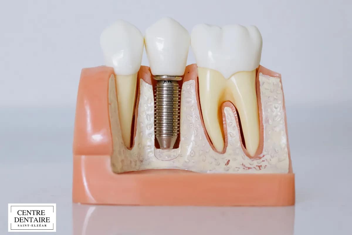 L’évaluation par le dentiste : une étape essentielle