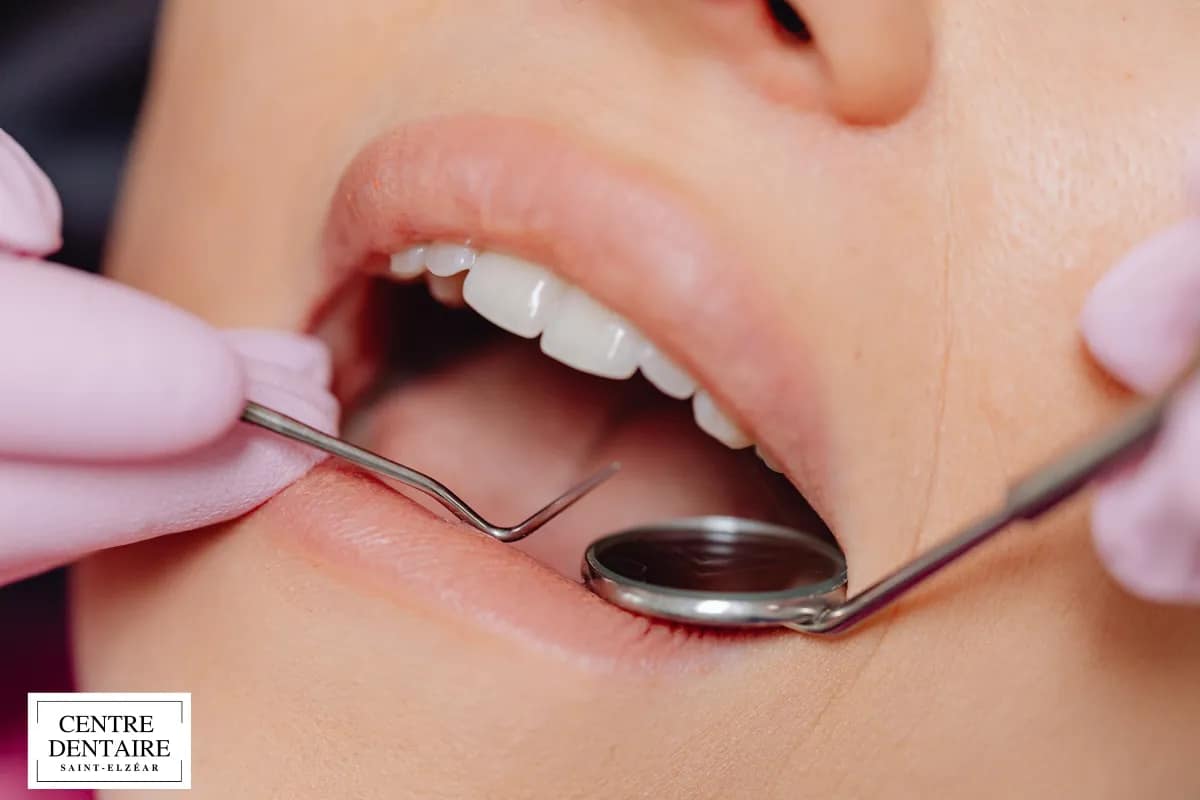 Les solutions pour minimiser la douleur