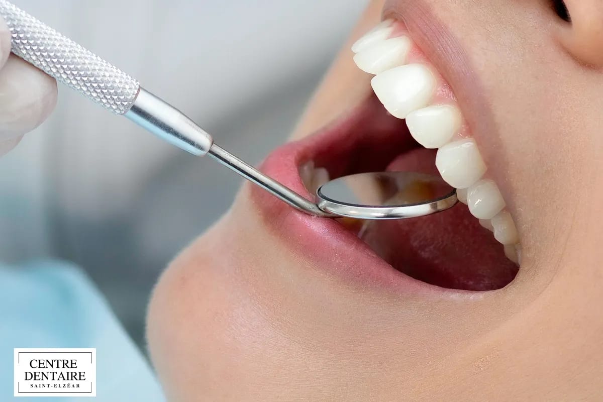 Les signes d’un implant en difficulté