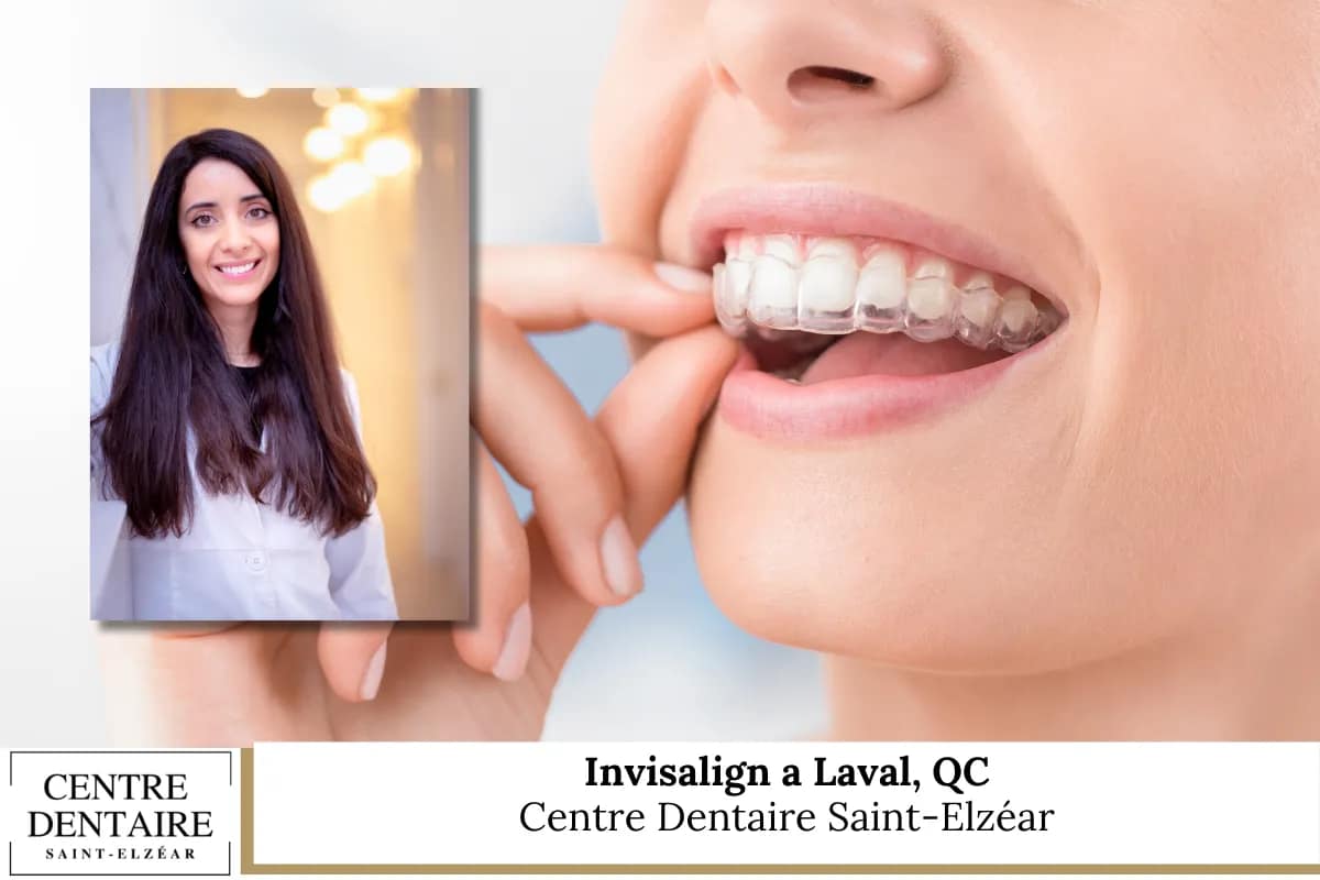 Invisalign a Laval, QC - Centre Dentaire Saint-Elzéar