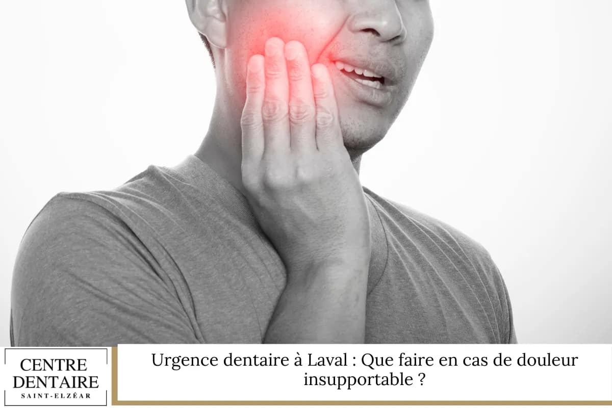 Urgence dentaire à Laval : Que faire en cas de douleur insupportable ?