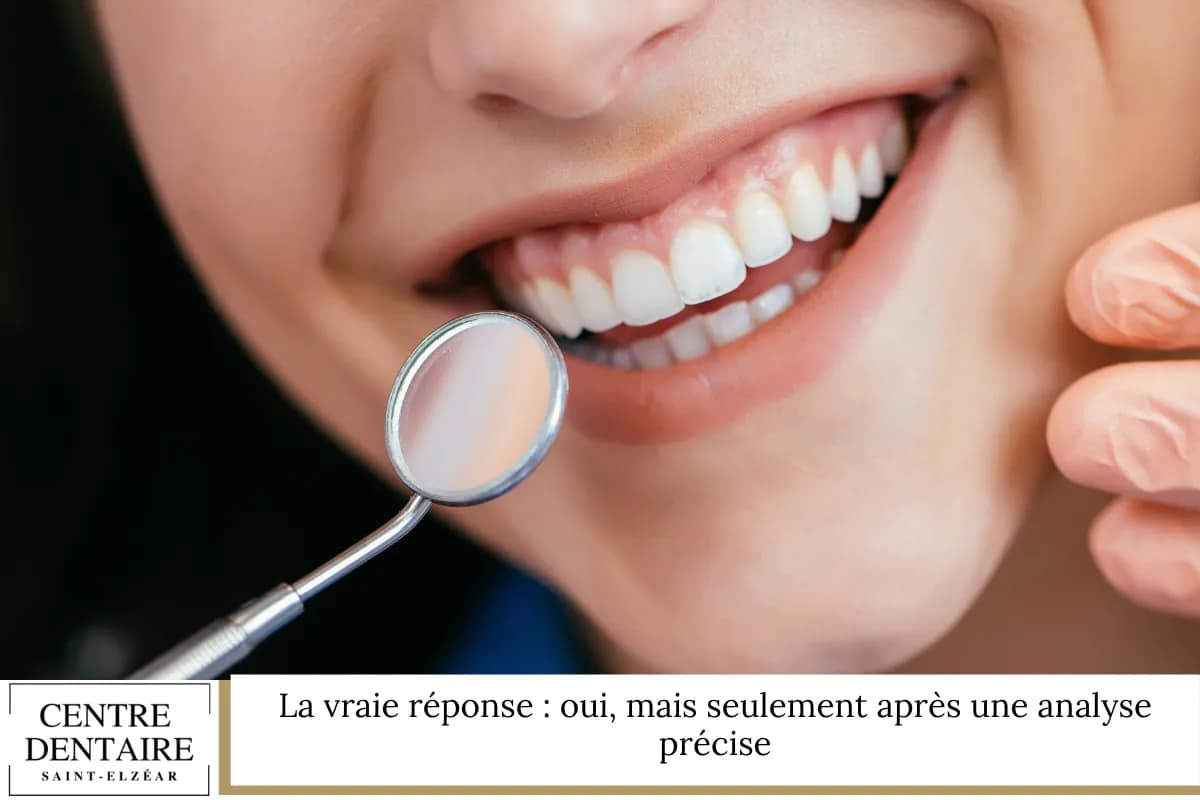 La vraie réponse : oui, mais seulement après une analyse précise