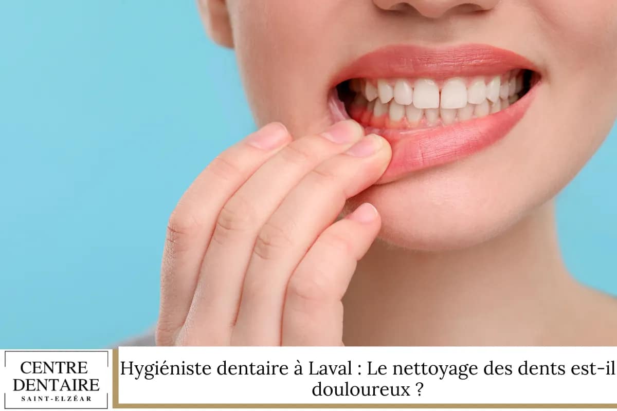 Hygiéniste dentaire à Laval : Le nettoyage des dents est-il douloureux ?