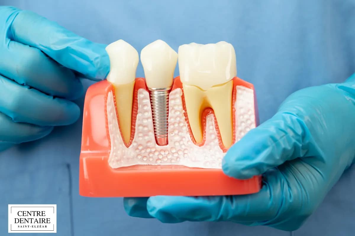 Prévenir les complications : les bonnes pratiques