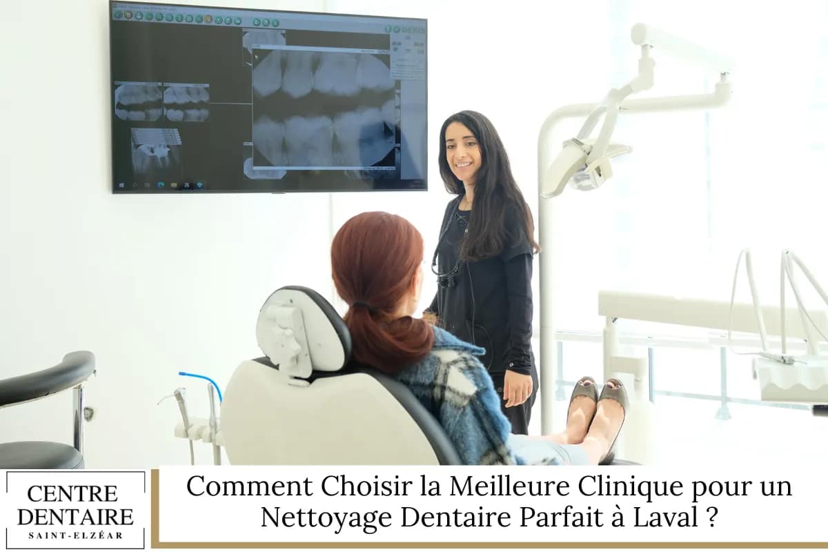 Comment Choisir la Meilleure Clinique pour un Nettoyage Dentaire Parfait à Laval