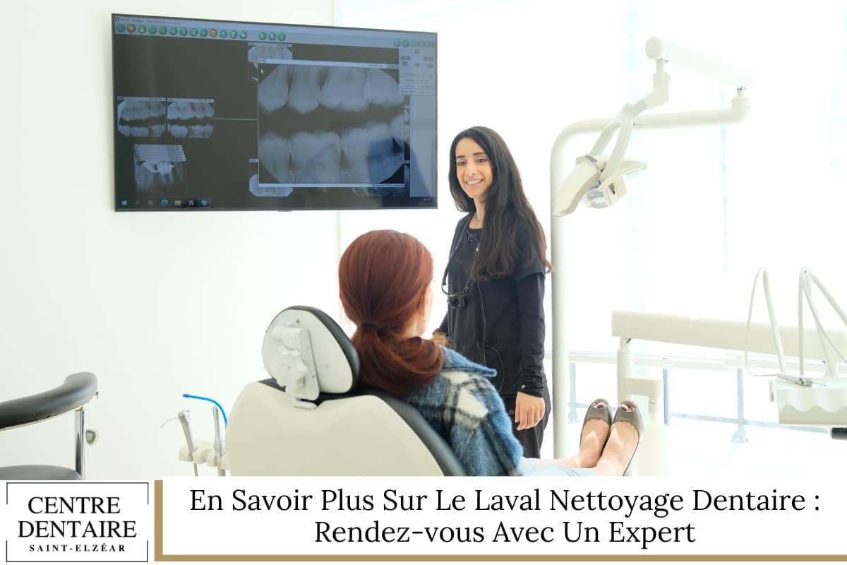 En Savoir Plus Sur Le Laval Nettoyage Dentaire Rendez-vous Avec Un Expert