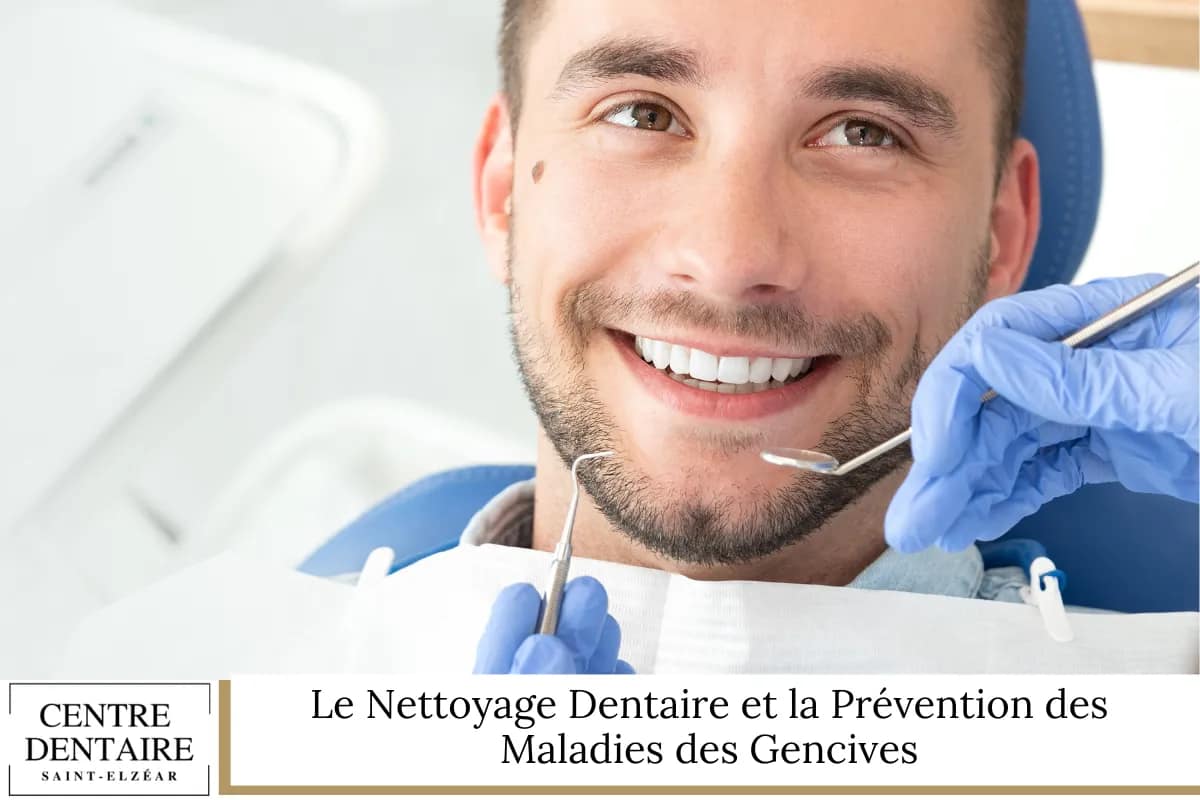 Le Nettoyage Dentaire et la Prévention des Maladies des Gencives