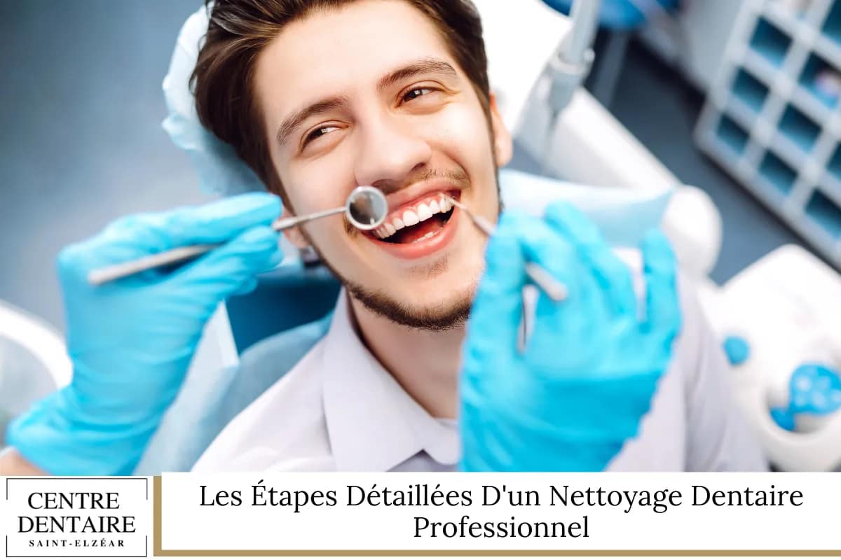 Les Étapes Détaillées D_un Nettoyage Dentaire Professionnel