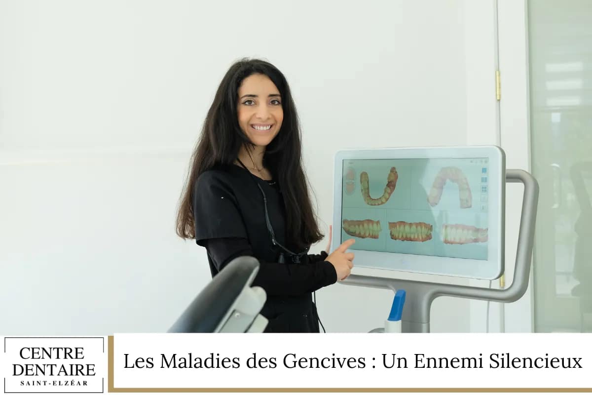 Les Maladies des Gencives Un Ennemi Silencieux