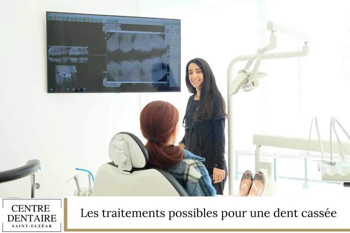 Les traitements possibles pour une dent cassée