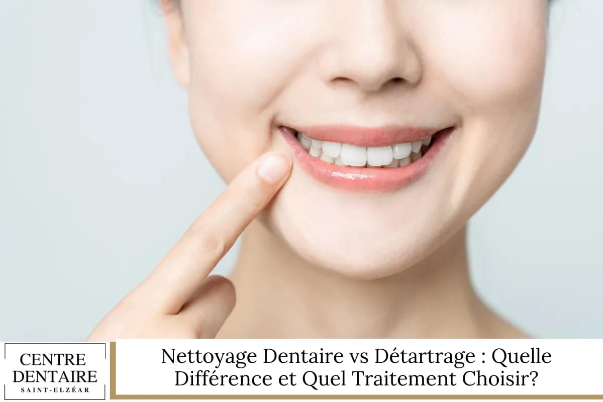 Nettoyage Dentaire vs Détartrage Quelle Différence et Quel Traitement Choisir