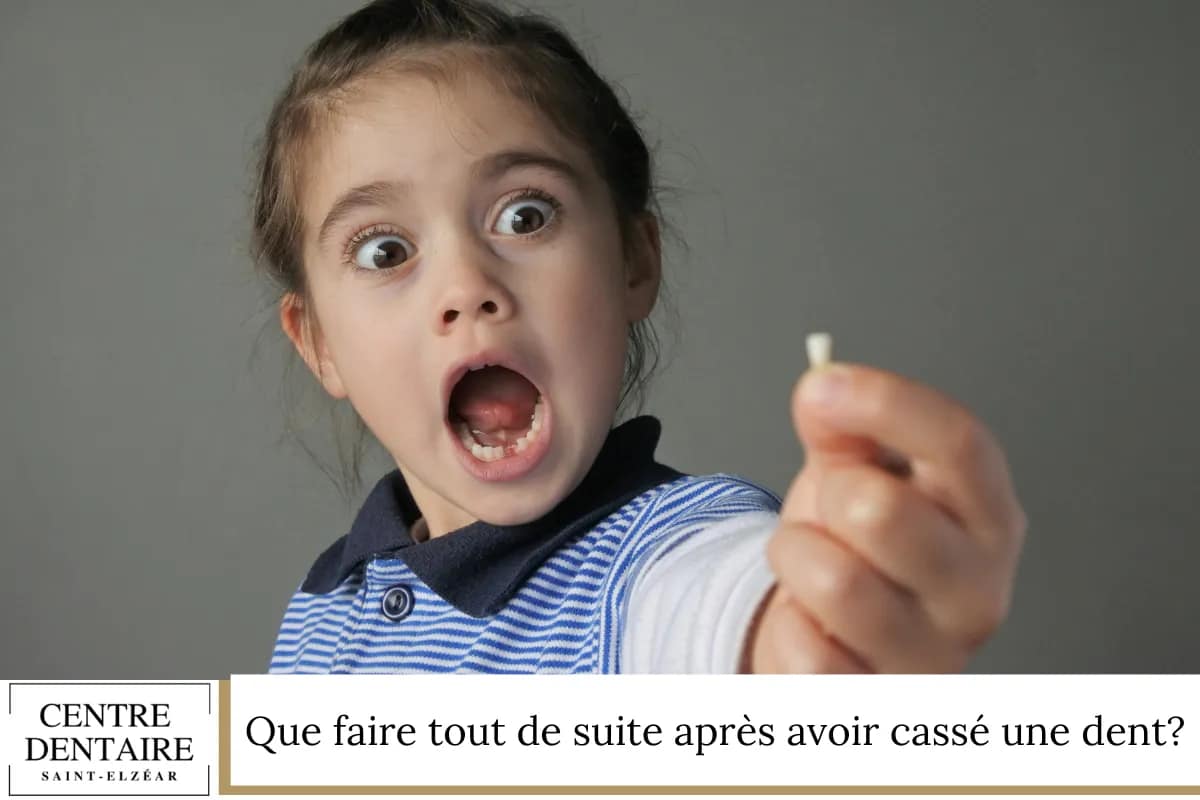 Que faire tout de suite après avoir cassé une dent
