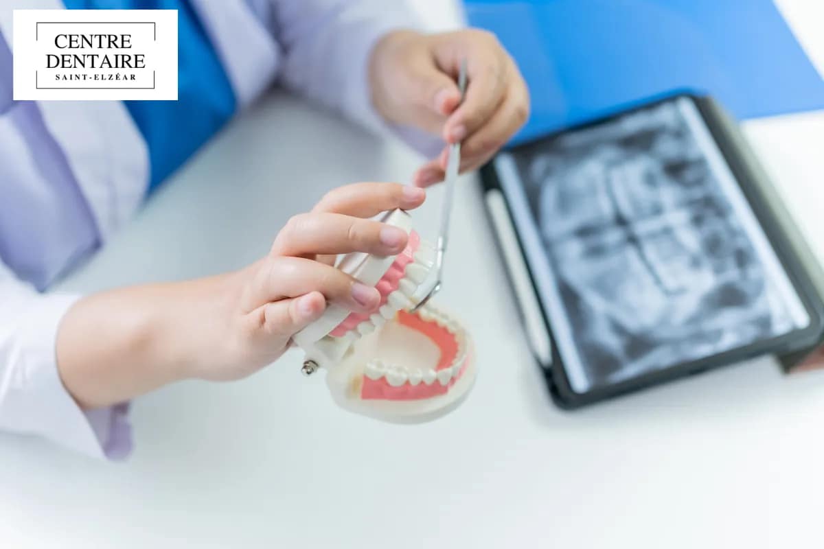 3. Traitement de Canal (Endodontie)