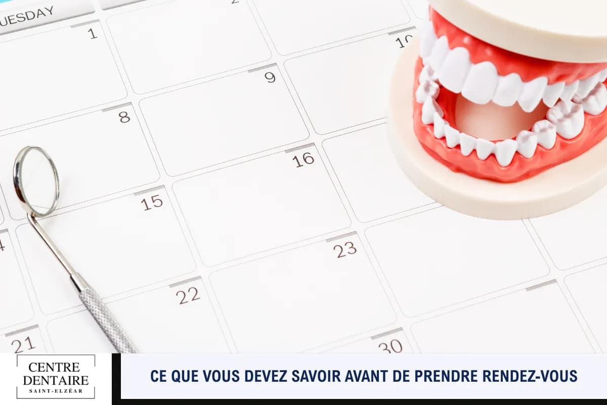 Ce que vous devez savoir avant de prendre rendez-vous