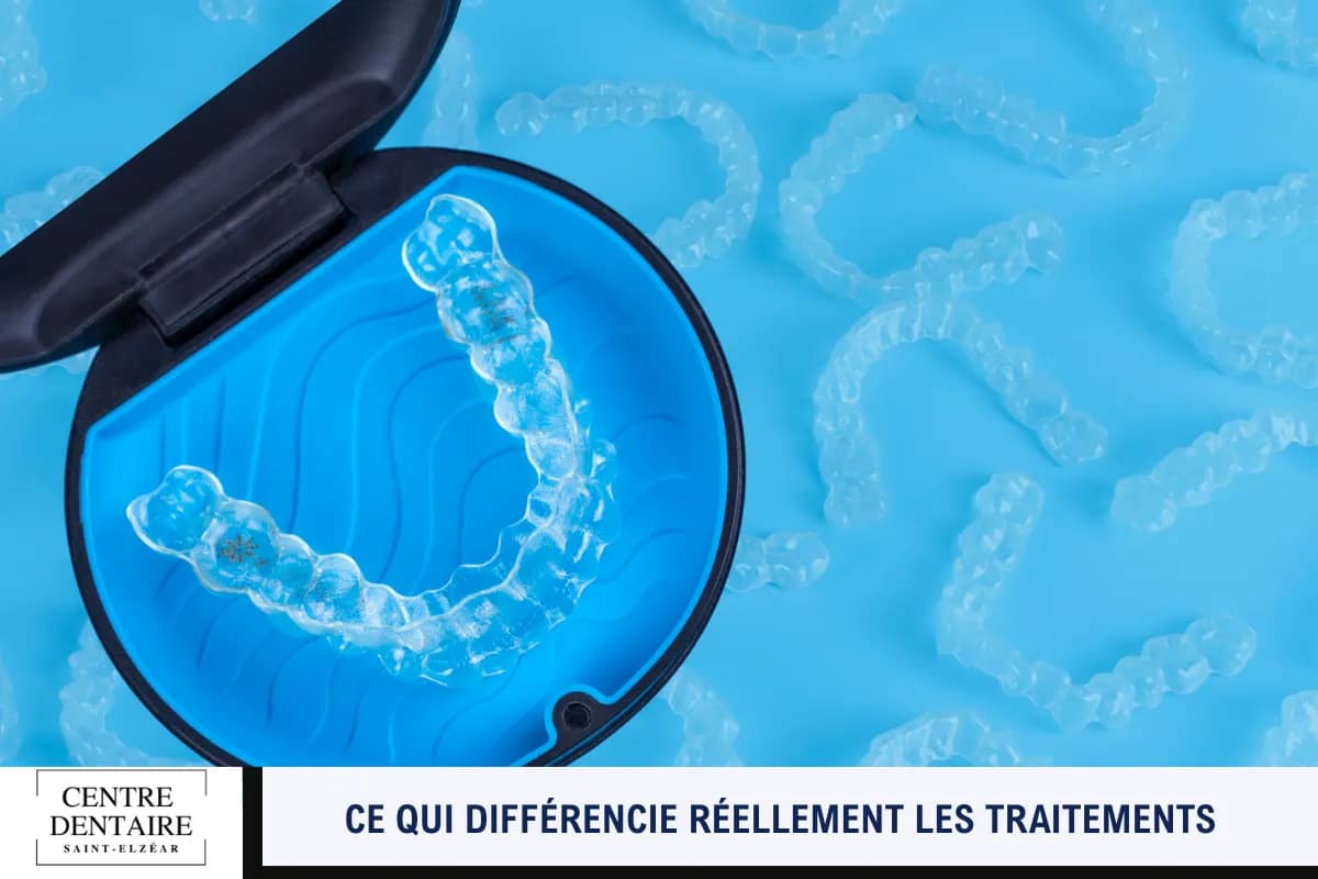 Ce qui différencie réellement les traitements