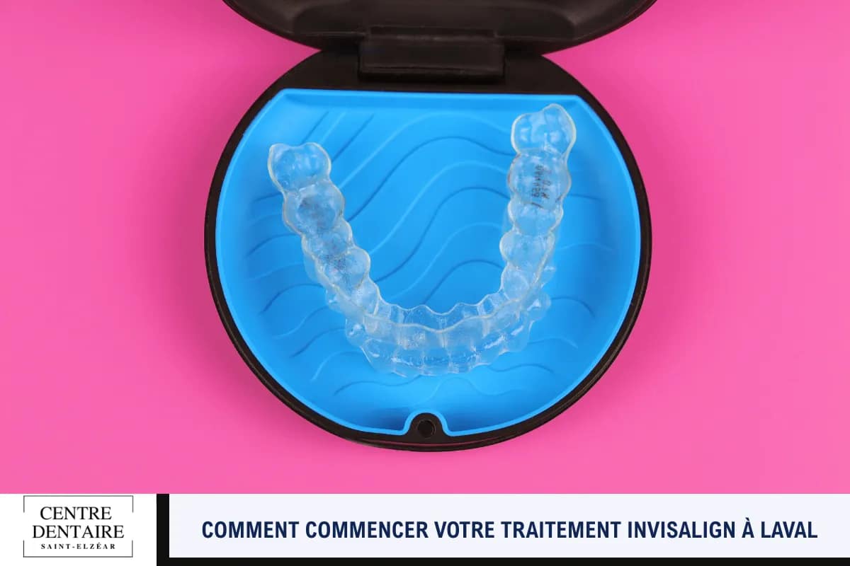 Comment commencer votre traitement Invisalign à Laval