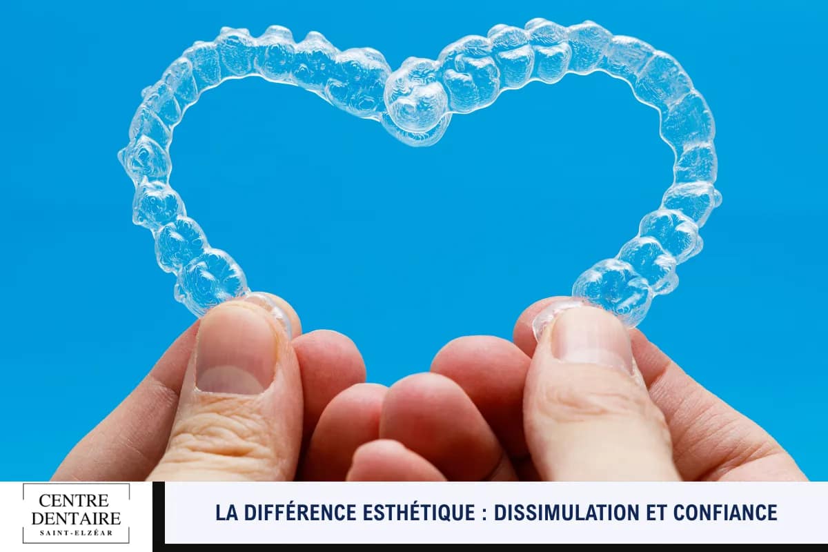 La différence esthétique _ dissimulation et confiance