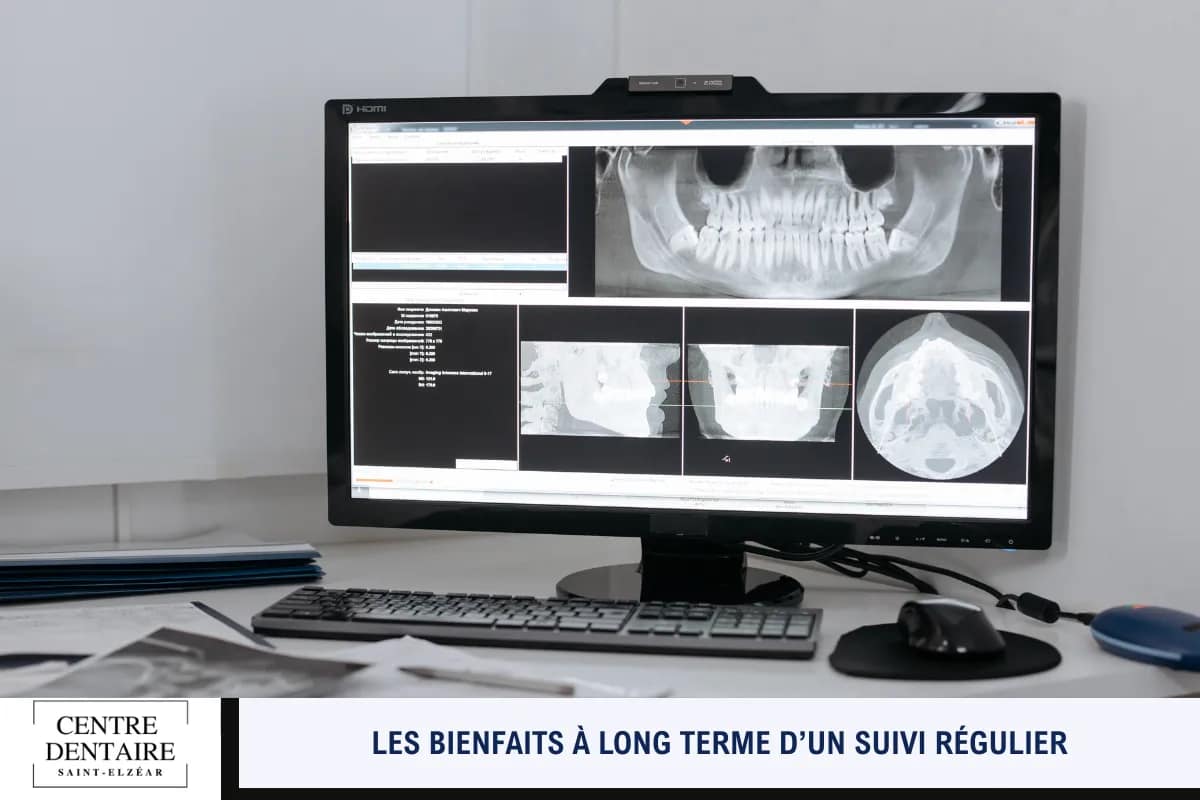 Les bienfaits à long terme d’un suivi régulier