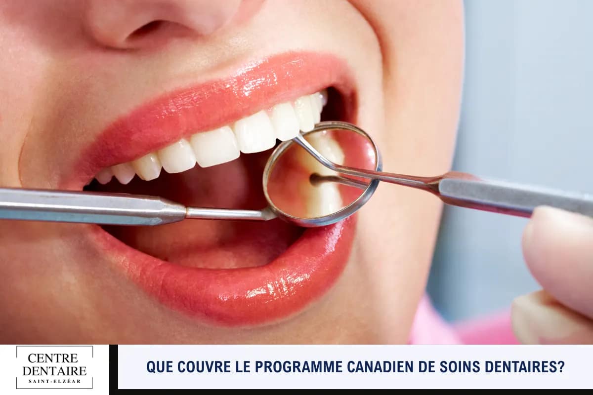 Que couvre le programme canadien de soins dentaires