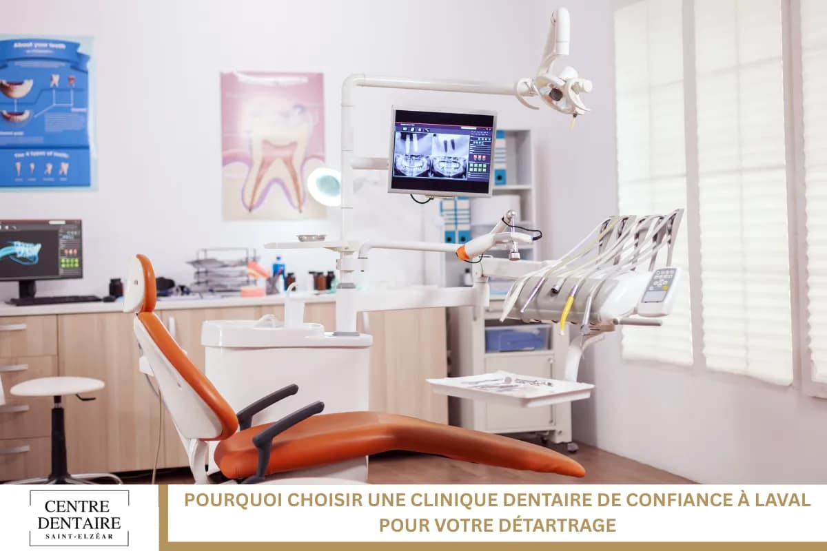 Pourquoi choisir une clinique dentaire de confiance à Laval pour votre détartrage