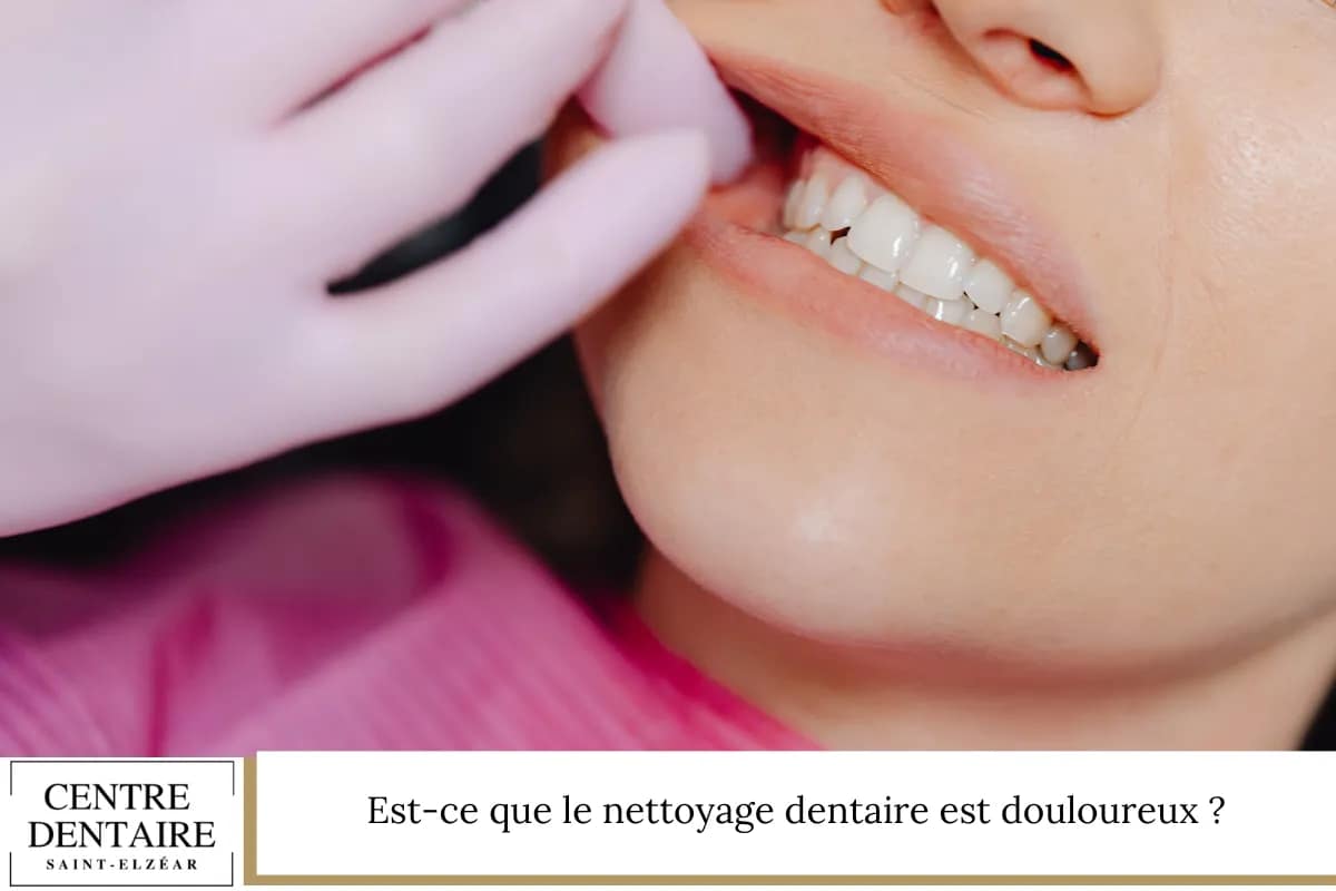 Est-ce que le nettoyage dentaire est douloureux ?