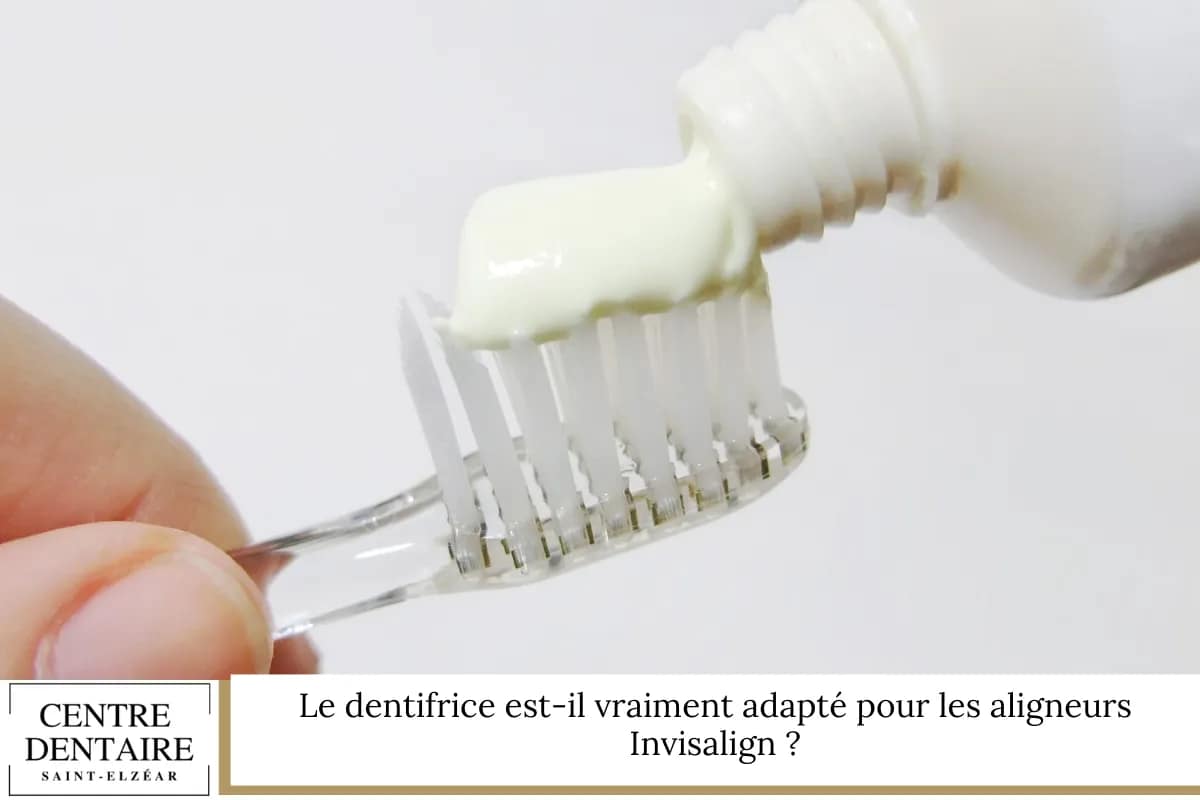 Le dentifrice est-il vraiment adapté pour les aligneurs Invisalign ?