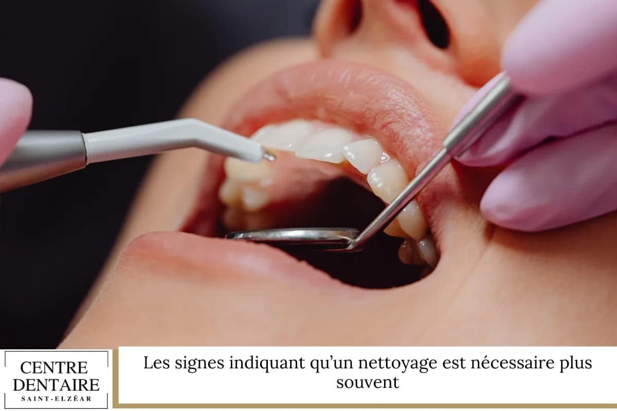 Les signes indiquant qu’un nettoyage est nécessaire plus souvent