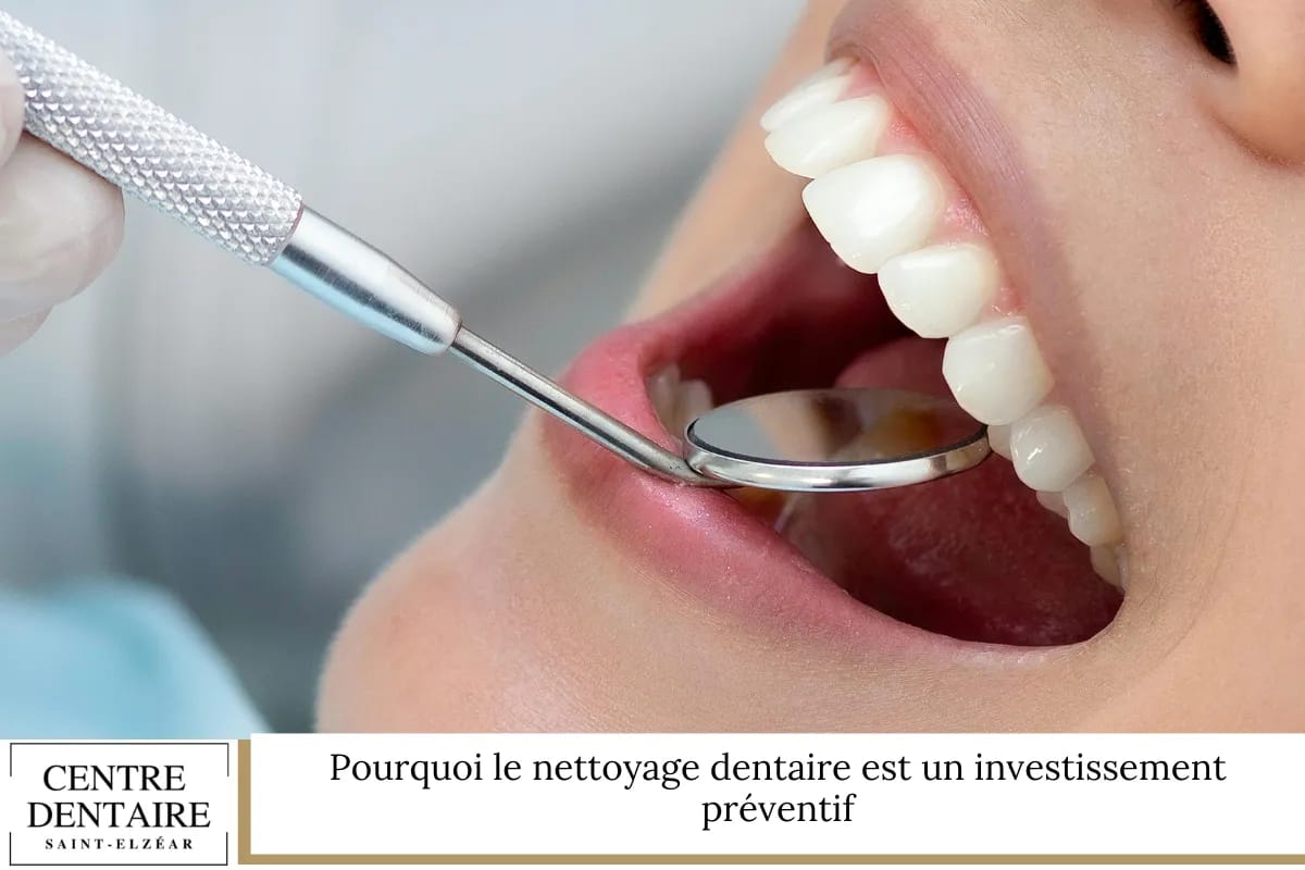 Pourquoi le nettoyage dentaire est un investissement préventif