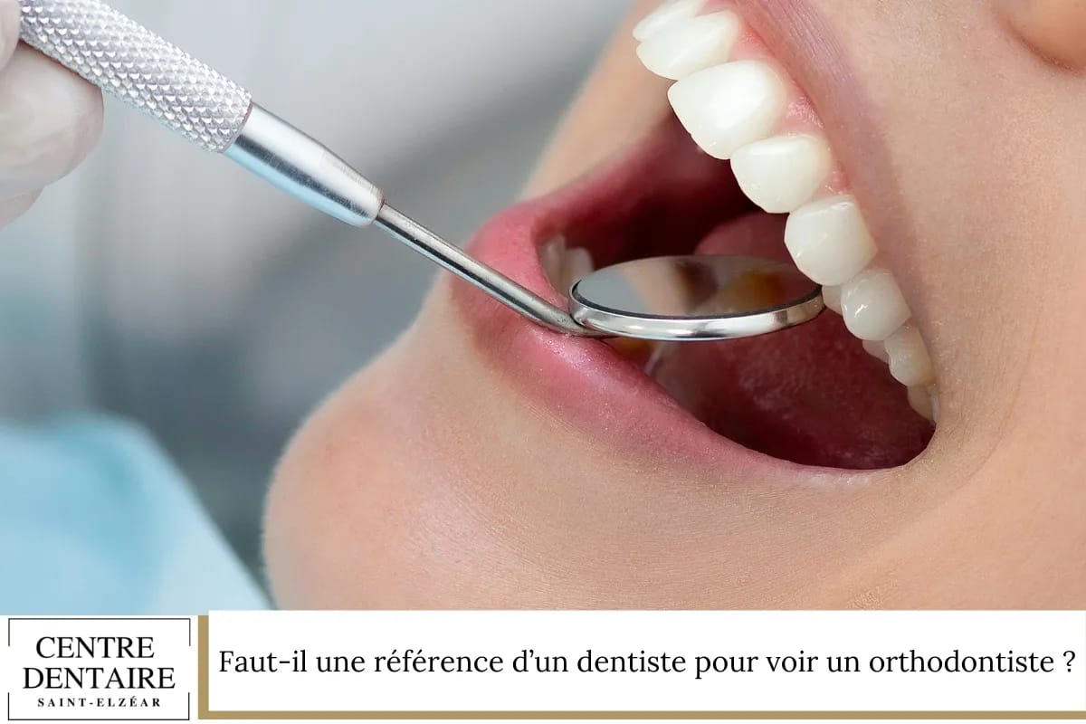 Faut-il une référence d’un dentiste pour voir un orthodontiste
