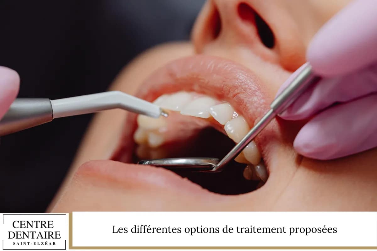 Les différentes options de traitement proposées