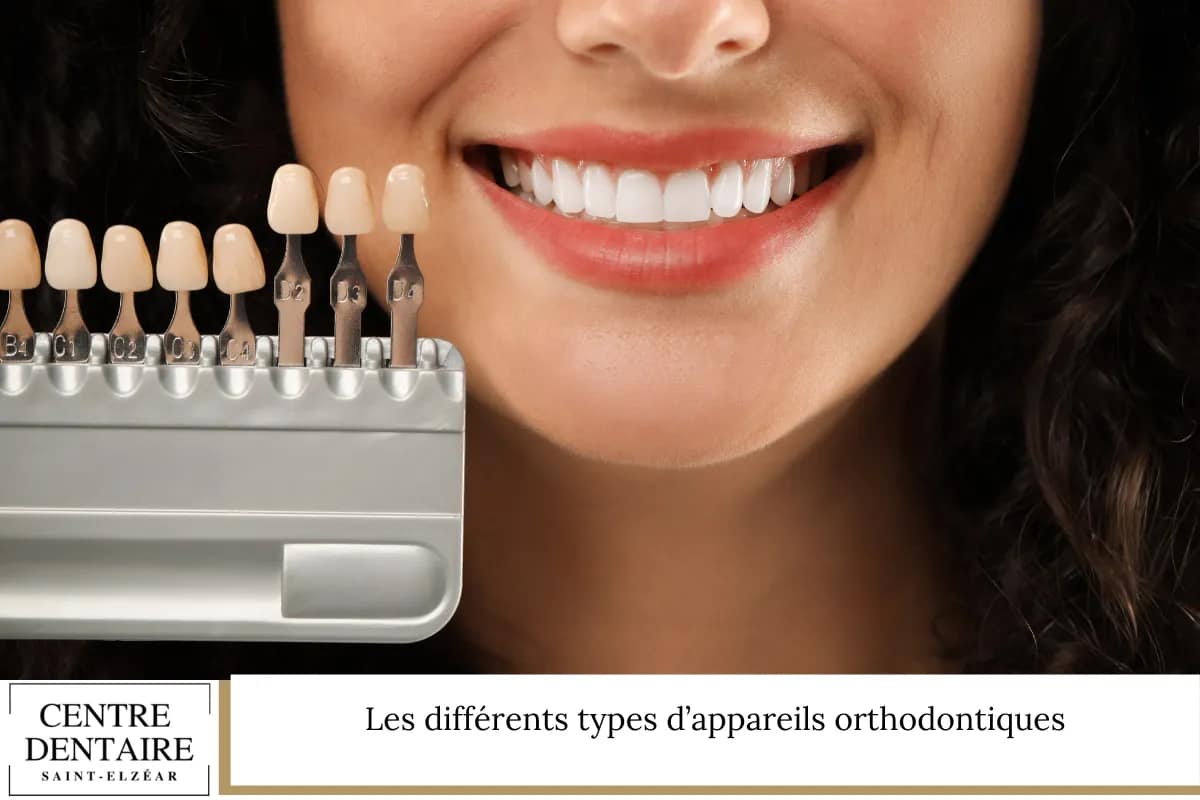 Les différents types d’appareils orthodontiques