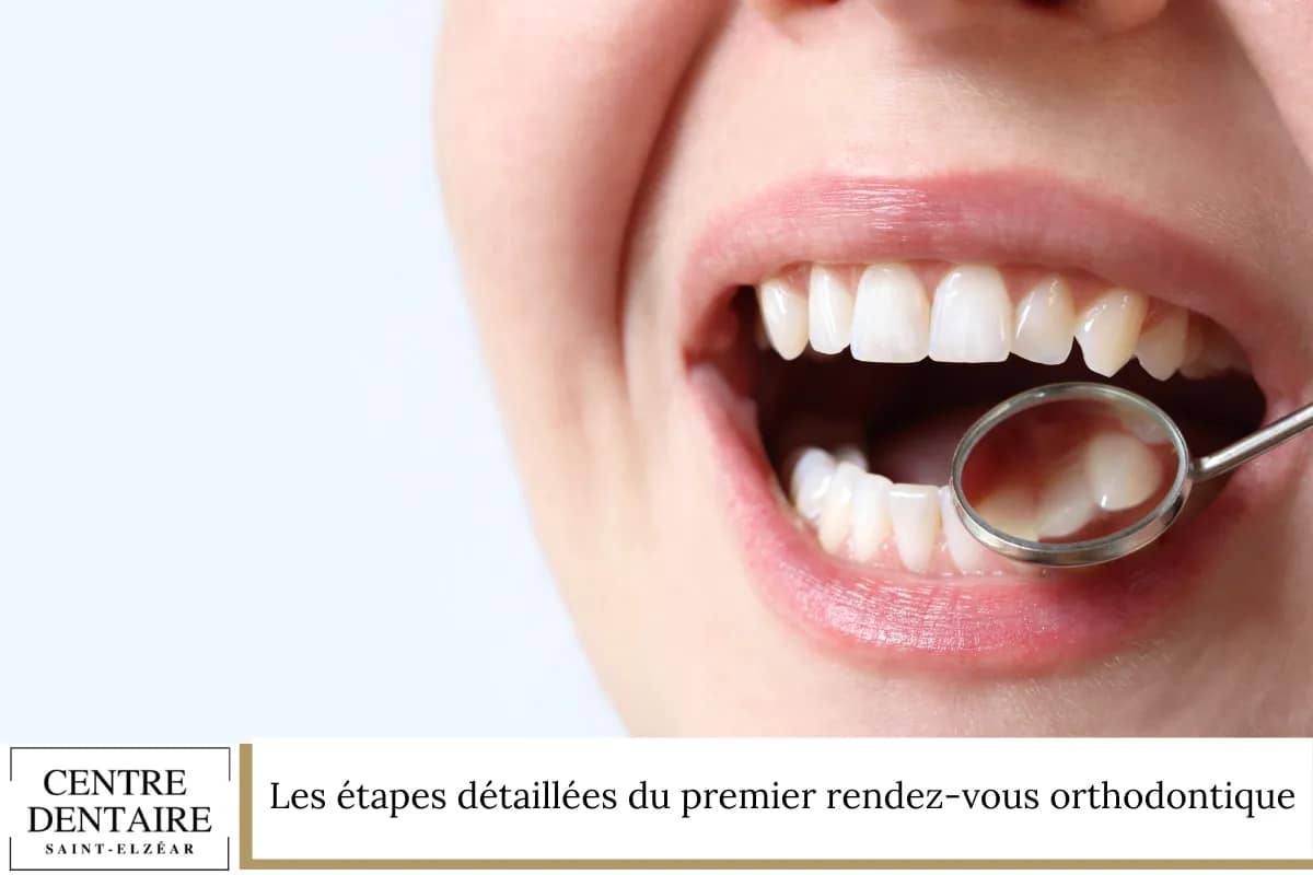 Les étapes détaillées du premier rendez-vous orthodontique