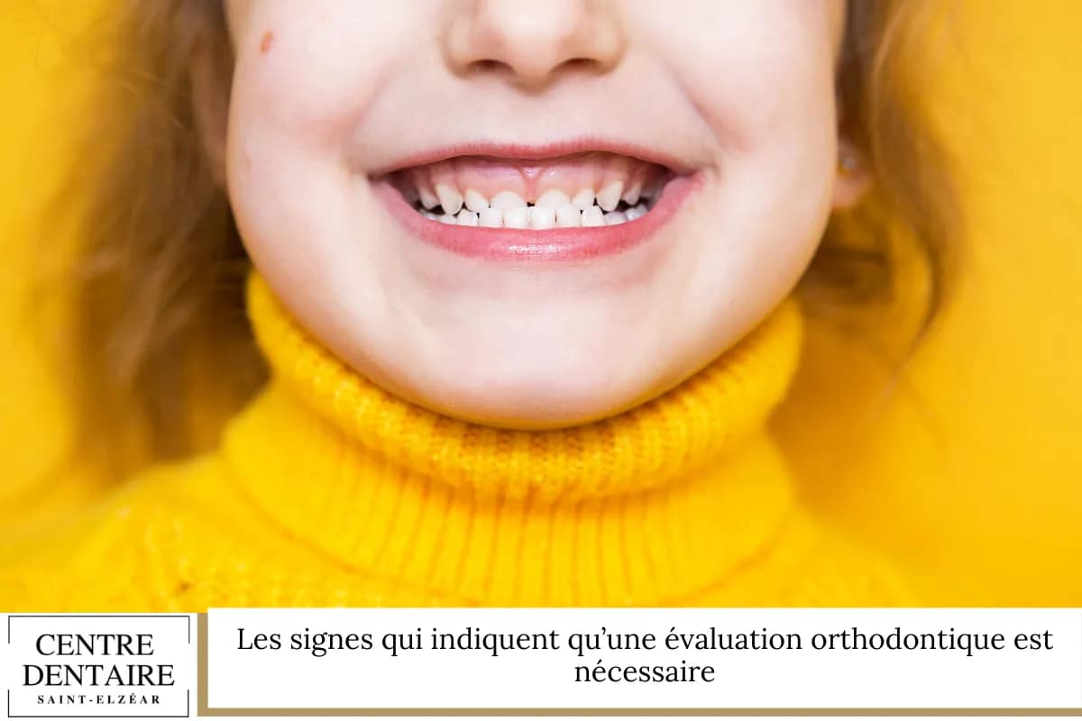 Les signes qui indiquent qu’une évaluation orthodontique est nécessaire