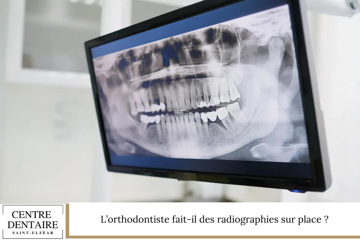 L’orthodontiste fait-il des radiographies sur place