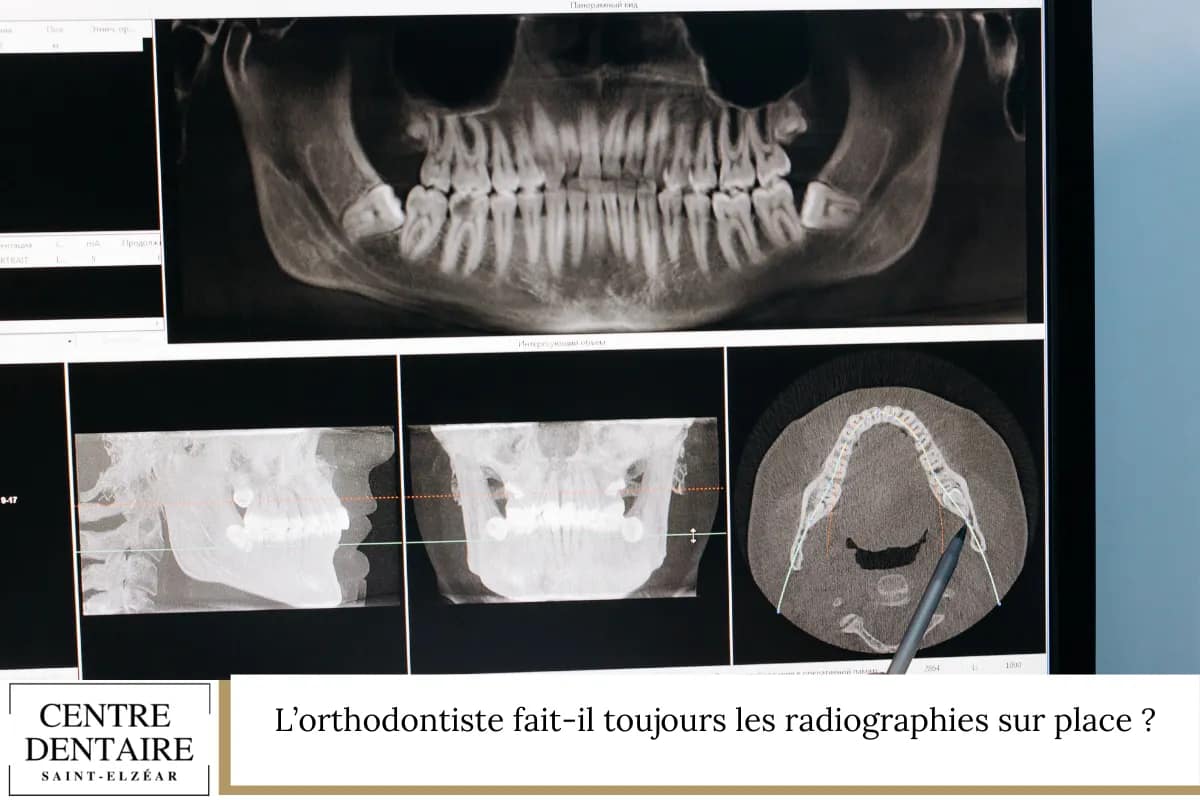 L’orthodontiste fait-il toujours les radiographies sur place