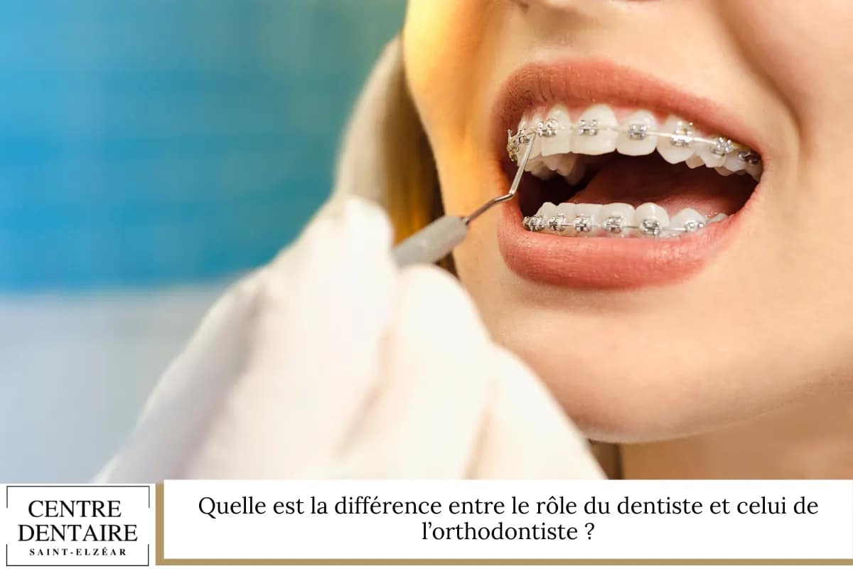 Quelle est la différence entre le rôle du dentiste et celui de l’orthodontiste