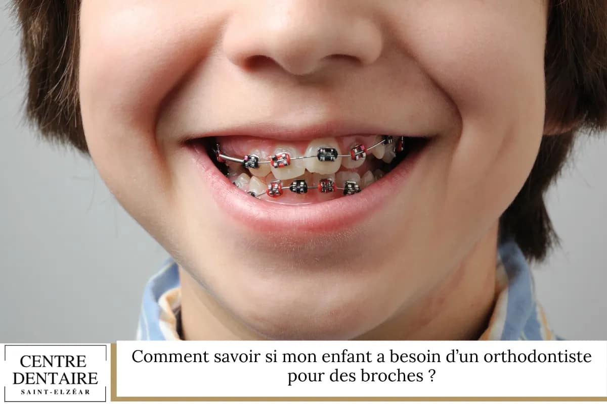 Comment savoir si mon enfant a besoin d’un orthodontiste pour des broches ?