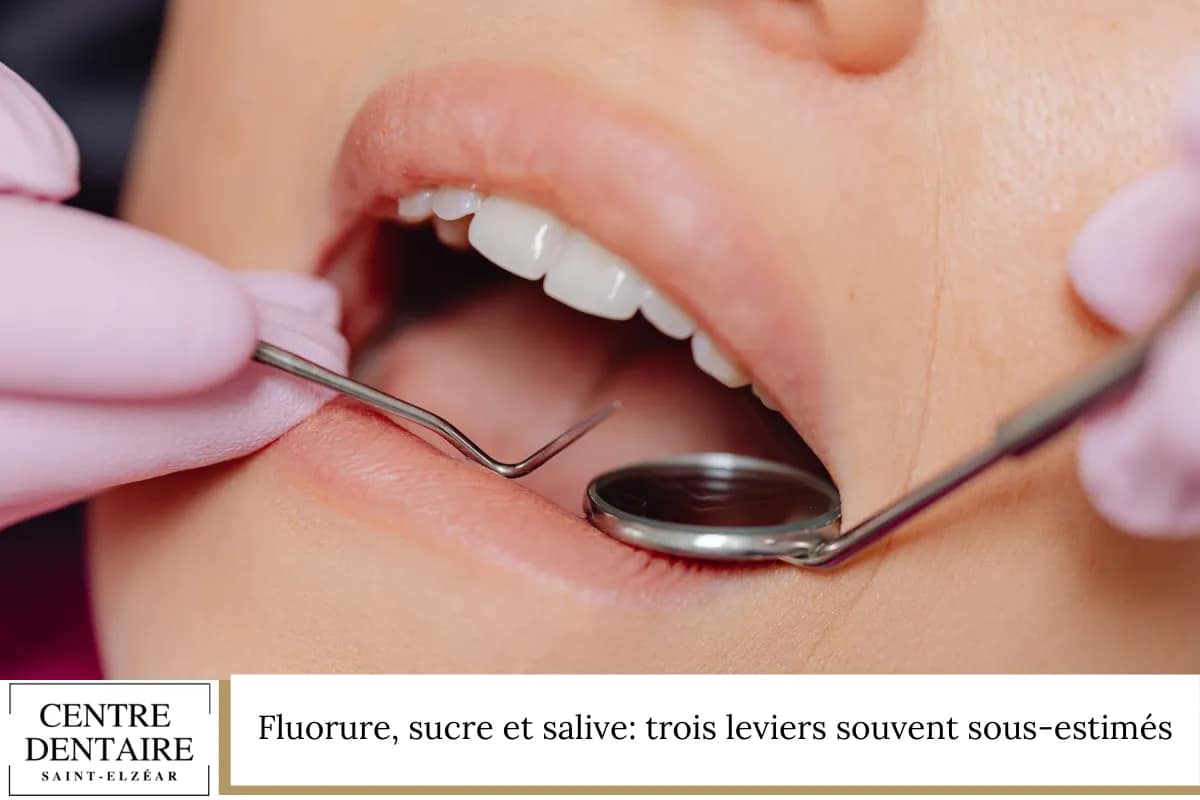 Fluorure, sucre et salive: trois leviers souvent sous-estimés