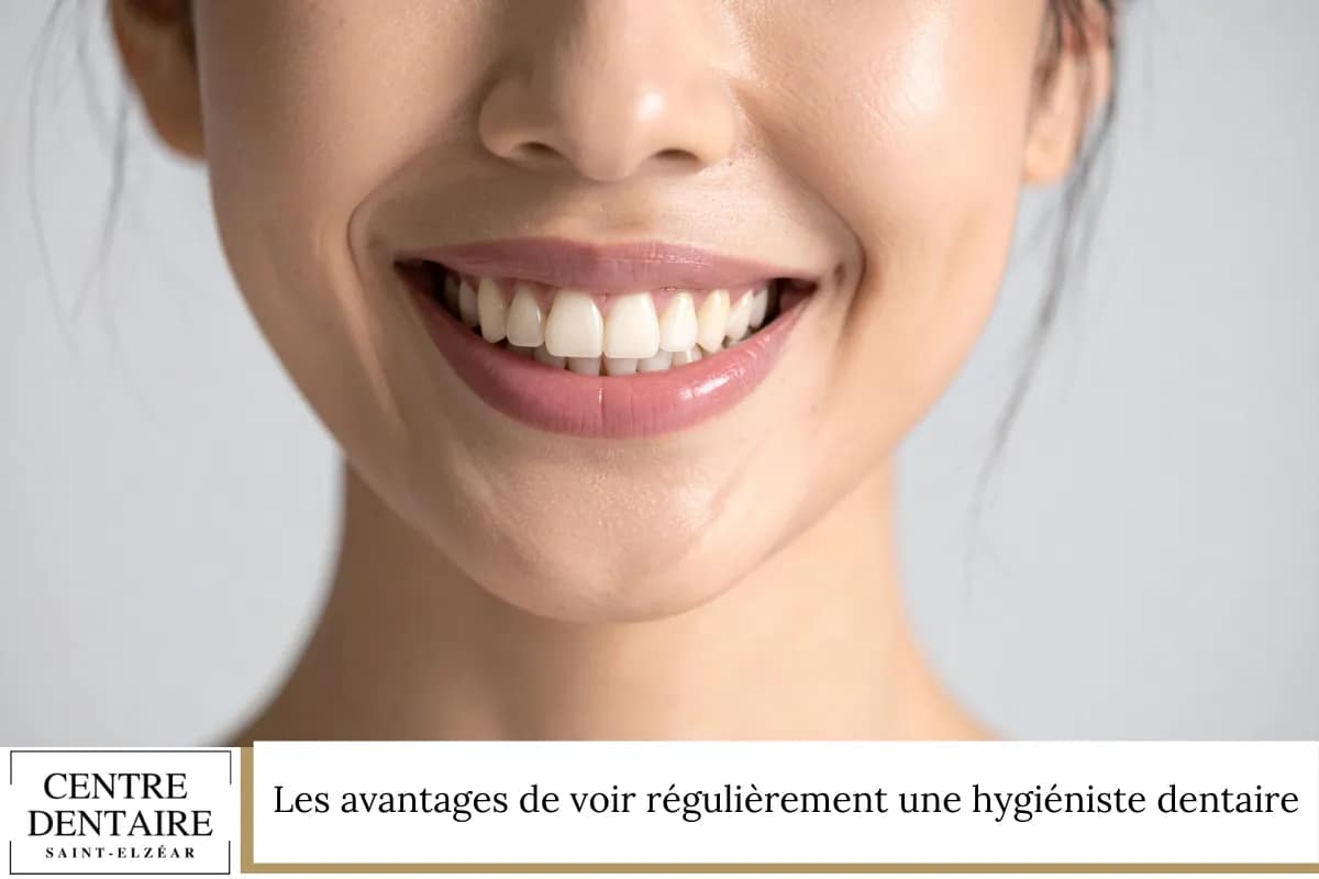 Les avantages de voir régulièrement une hygiéniste dentaire