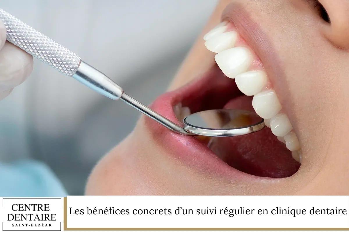 Les bénéfices concrets d’un suivi régulier en clinique dentaire