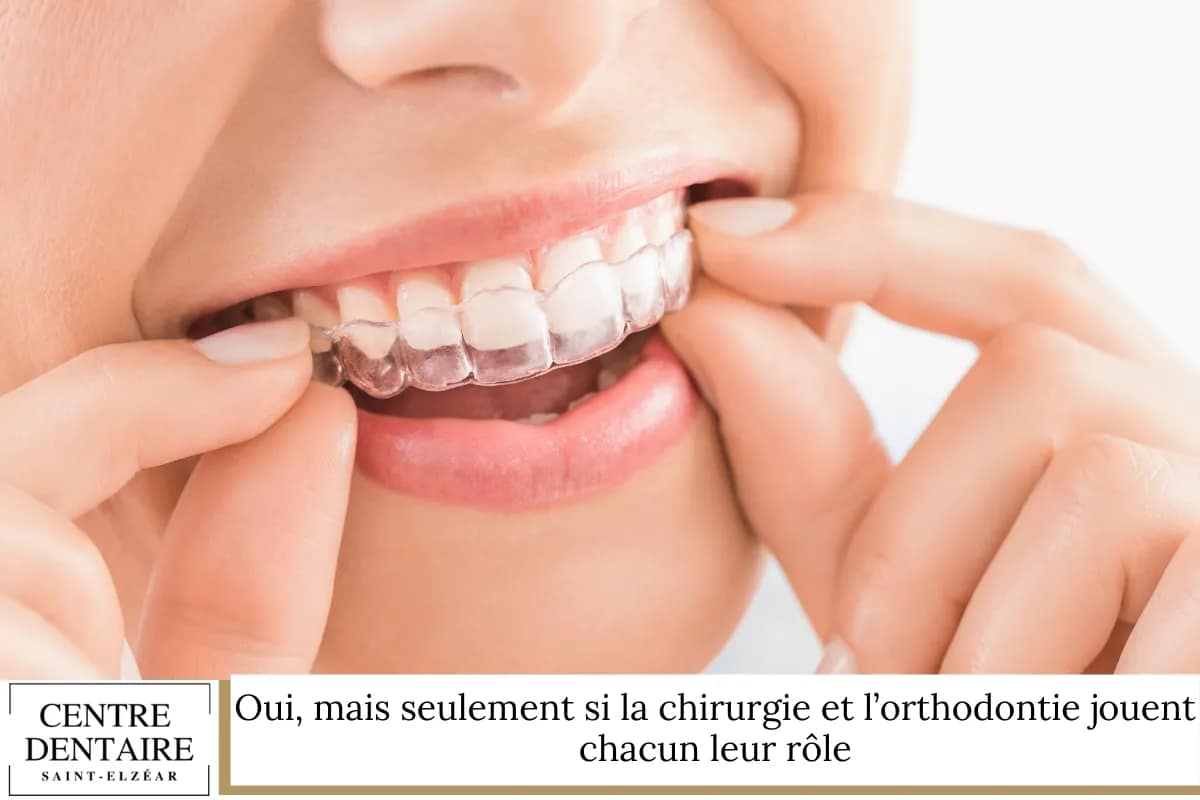 Oui, mais seulement si la chirurgie et l’orthodontie jouent chacun leur rôle