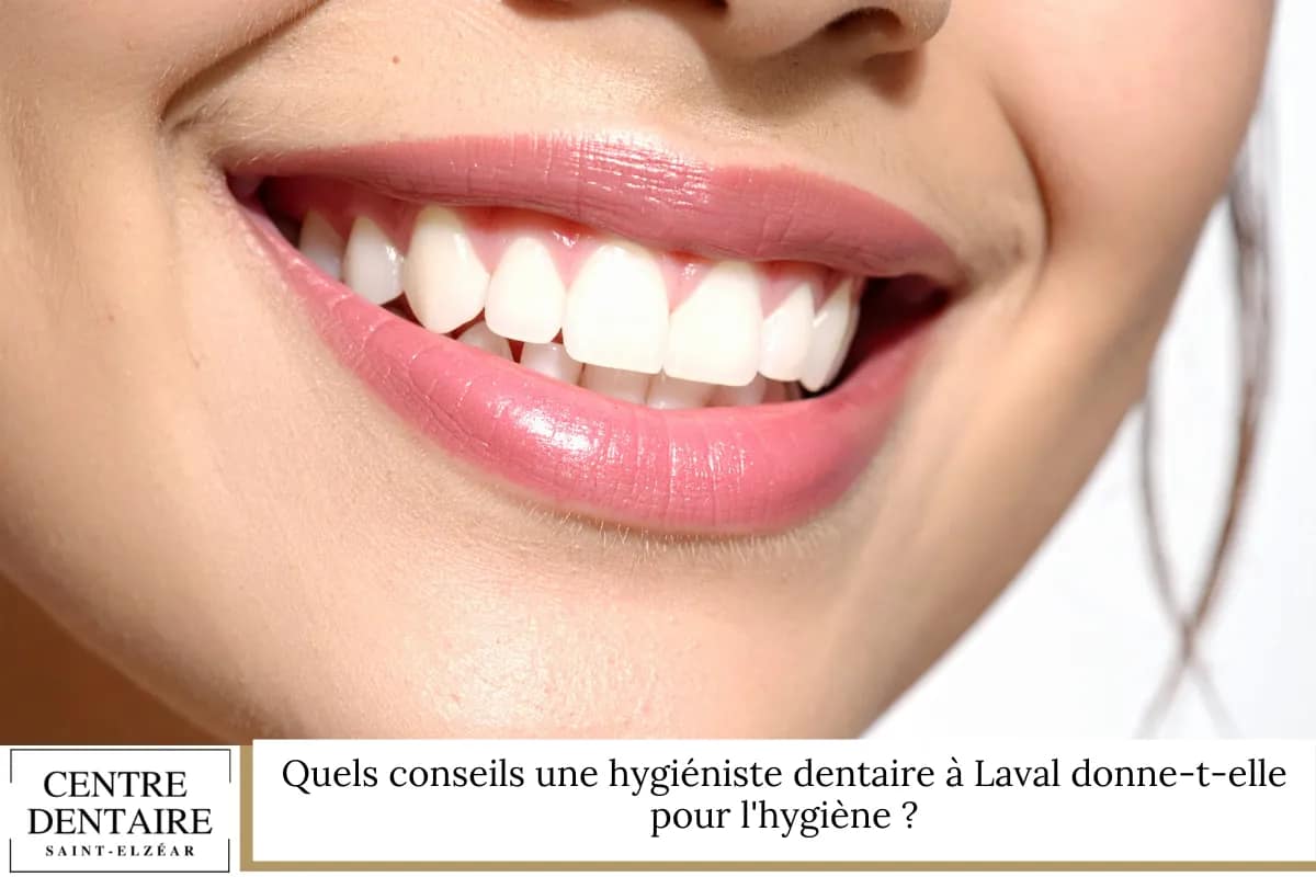 Quels conseils une hygiéniste dentaire à Laval donne-t-elle pour l'hygiène ?