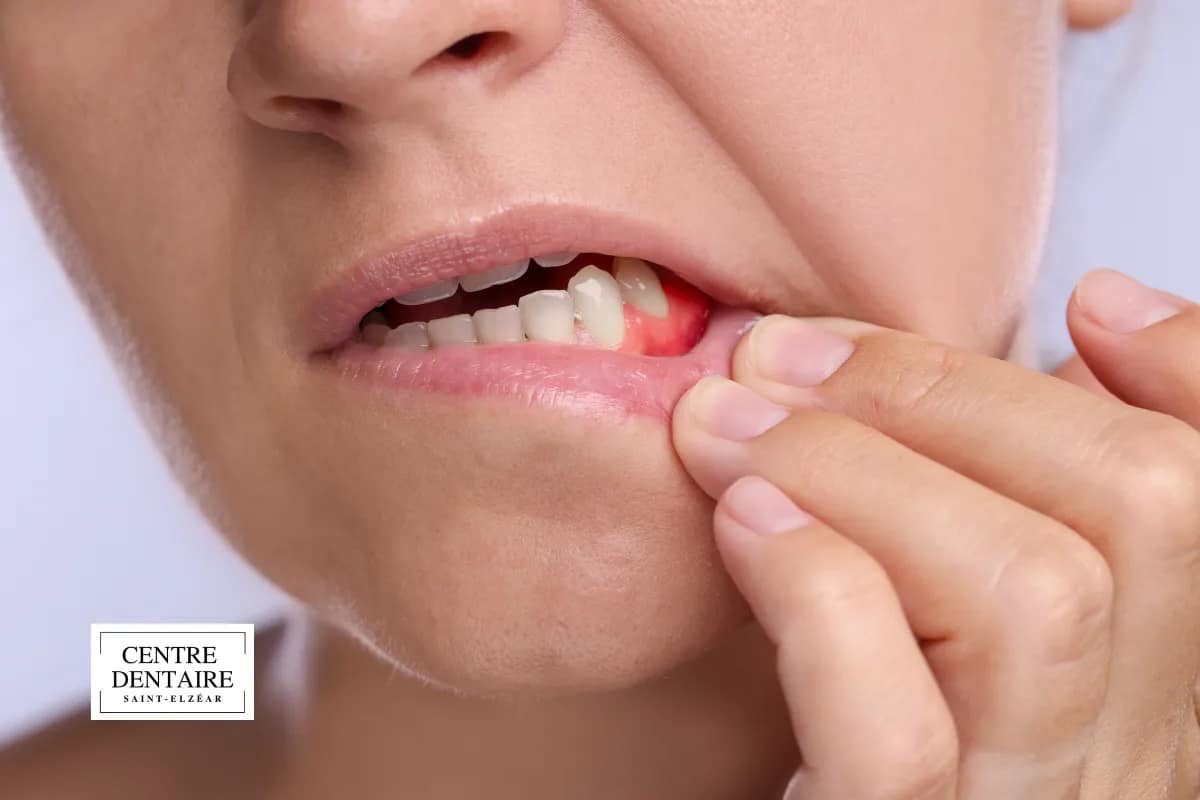 Ce qui alerte particulièrement l'hygiéniste avant même d'examiner la bouche