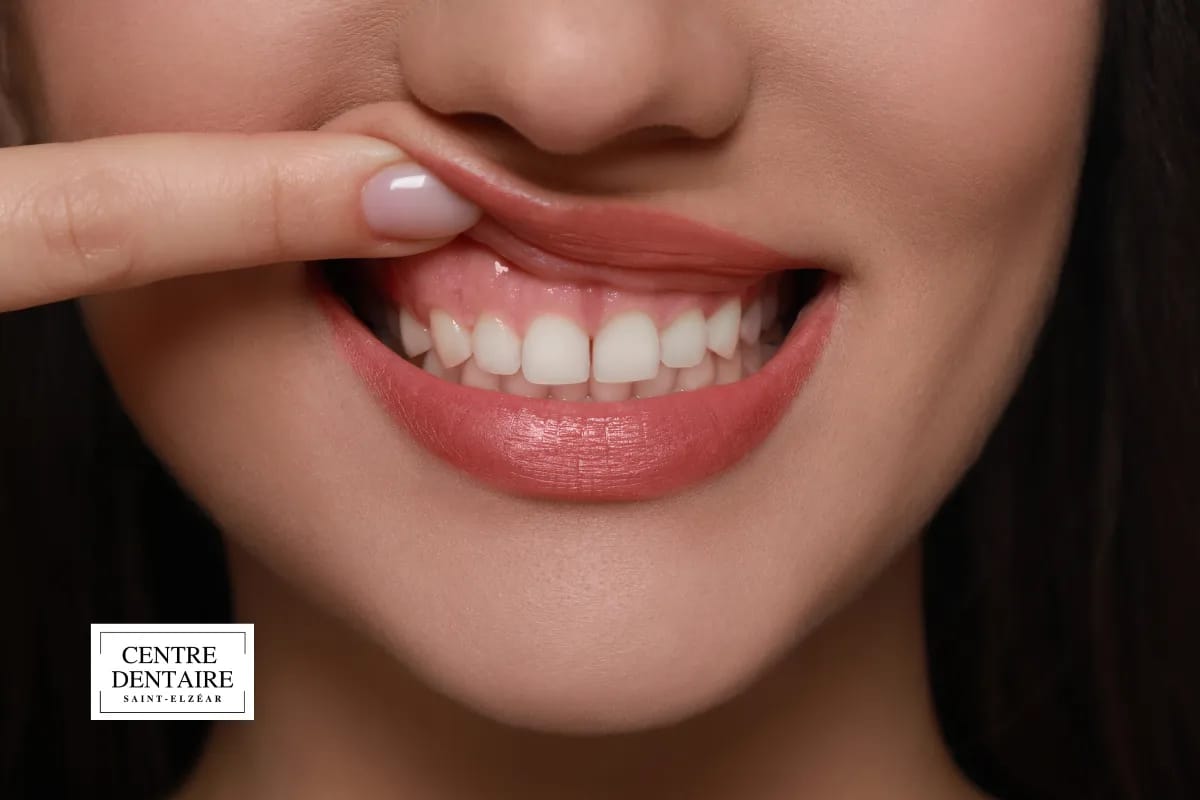 Comment l'hygiéniste traduit ces signes en plan de soins et conseils à domicile