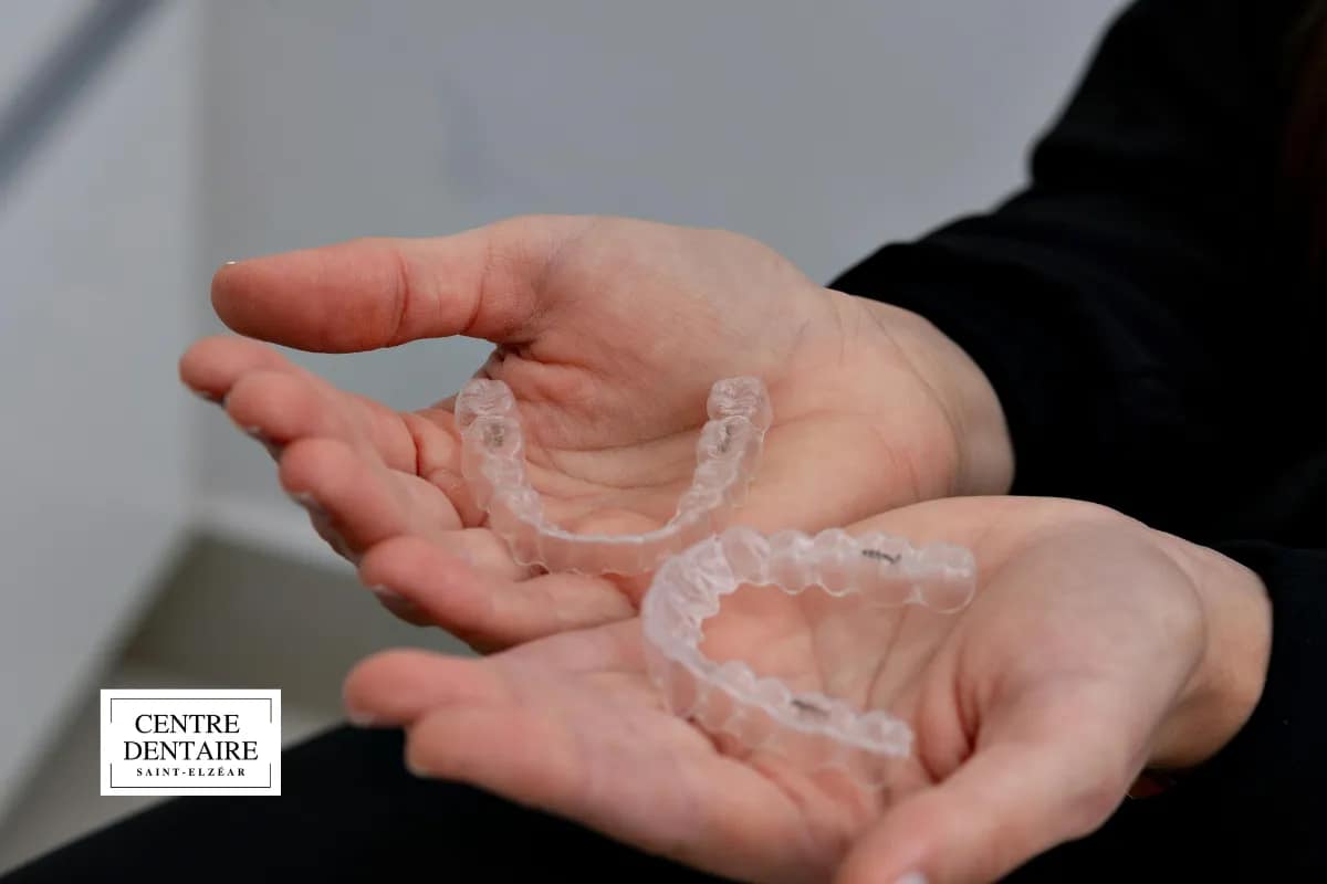 Comment savoir si votre Invisalign ne fonctionne vraiment pas ?