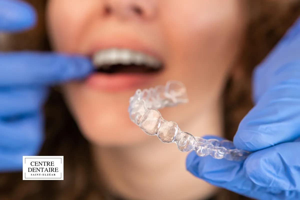 Comment votre dentiste à Laval remet le traitement Invisalign sur les rails
