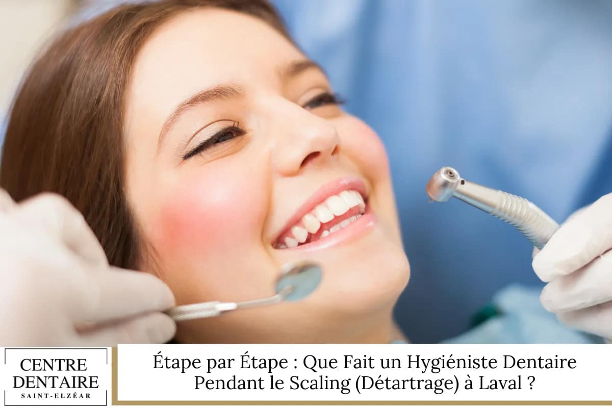 Étape par Étape : Que Fait un Hygiéniste Dentaire Pendant le Scaling (Détartrage) à Laval ?
