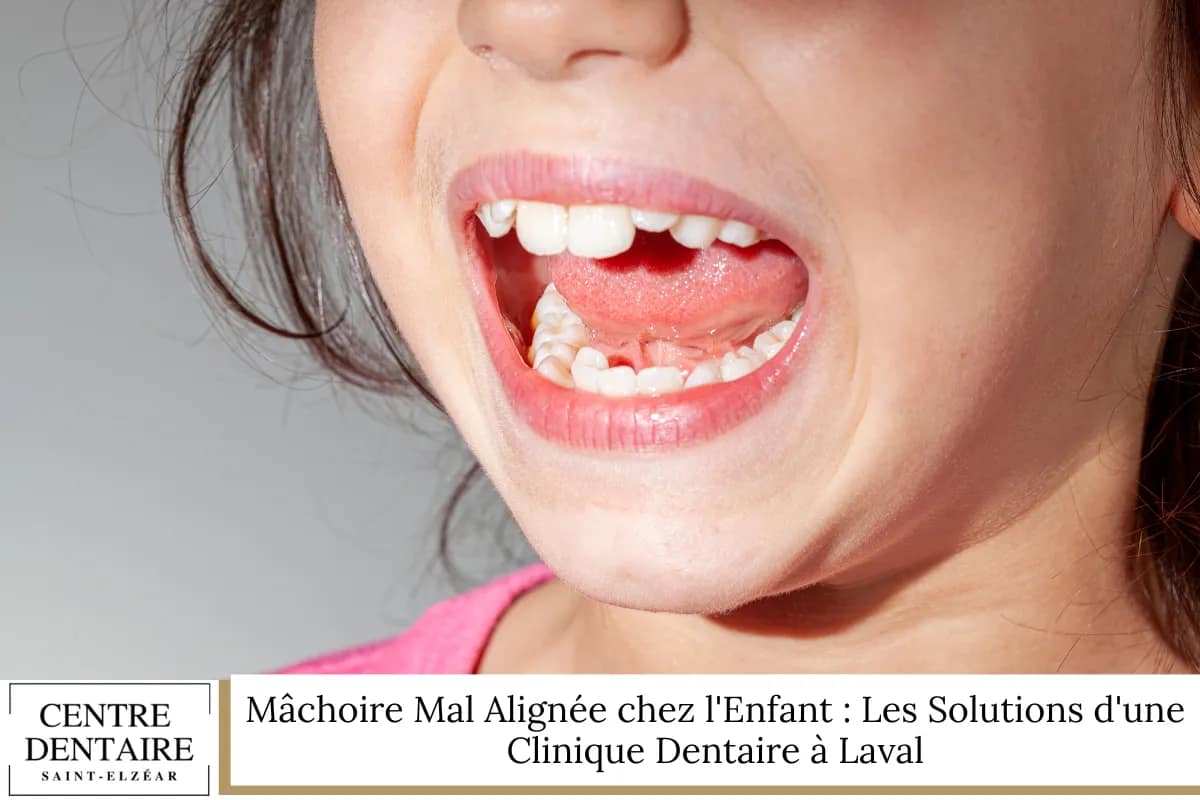 Mâchoire Mal Alignée chez l'Enfant : Les Solutions d'une Clinique Dentaire à Lava