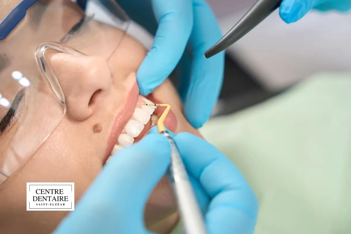 Quand un hygiéniste dentaire recommande un scaling (détartrage) à Laval