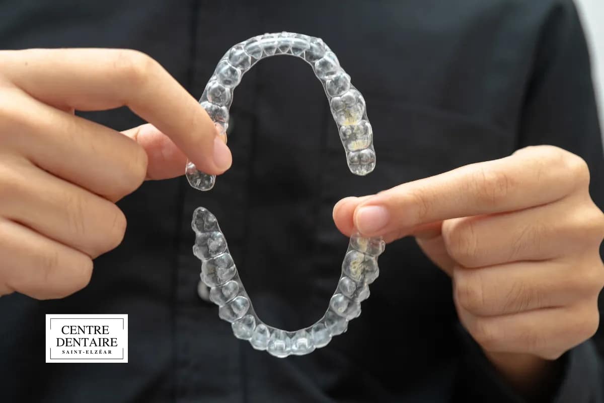 Que faire tout de suite si vos gouttières n'épousent plus les dents ?
